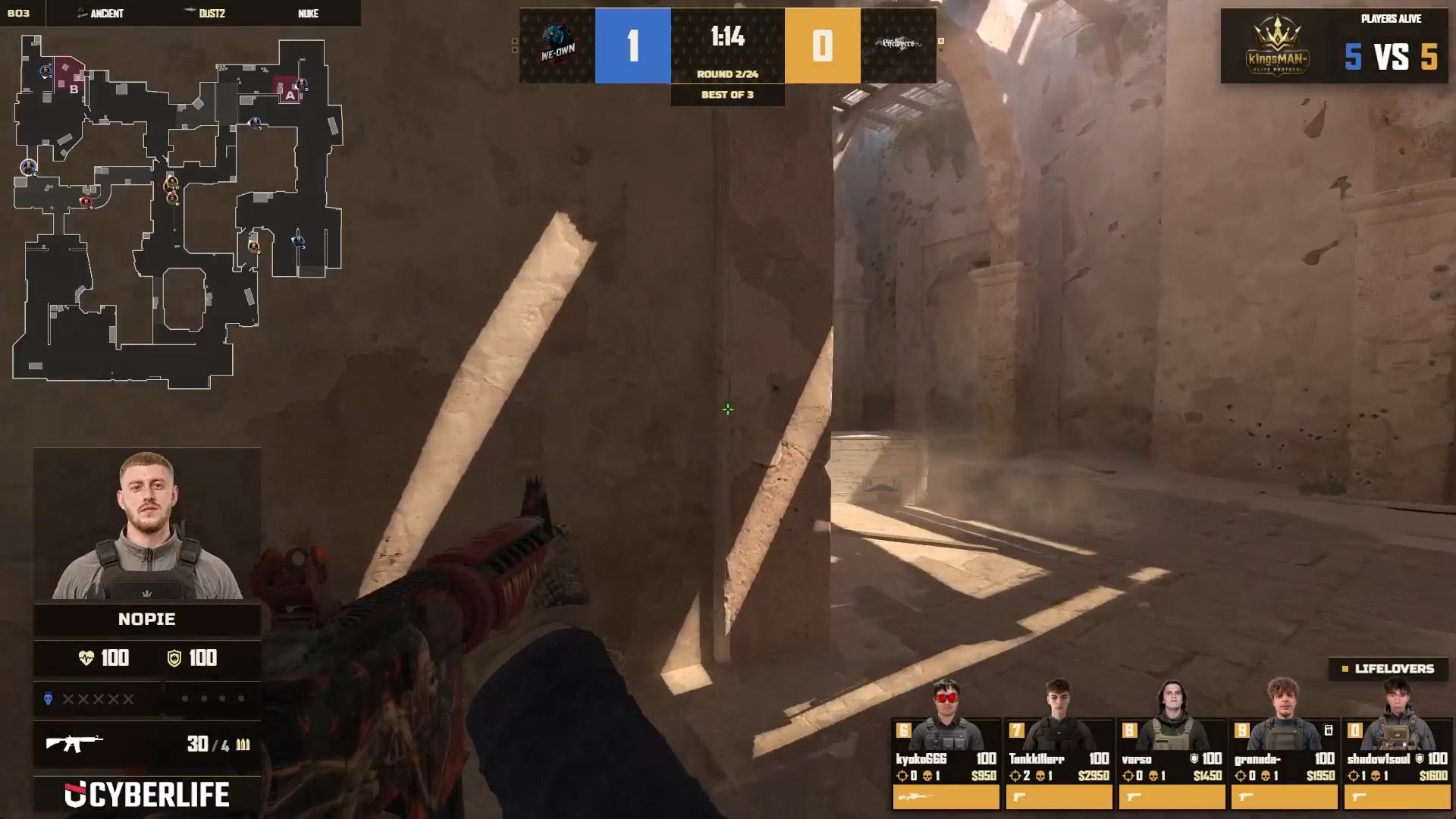 NOPiE Ace